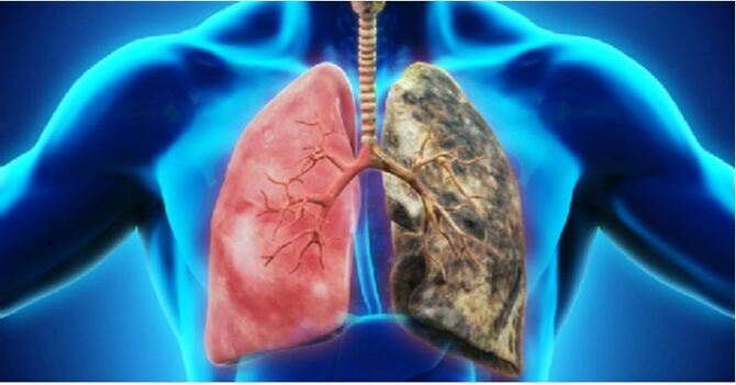 ফুসফুসের ময়লা পরিষ্কার হবে ভেষজ ৬ খাবারে