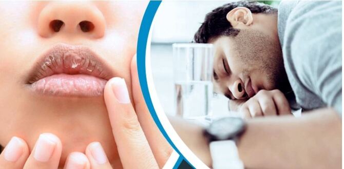 রোজায় শরীর পানিশূন্য হচ্ছে, বুঝবেন যেসব লক্ষণে