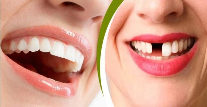 নতুন দাঁত গজানোর উপায় আবিষ্কার!