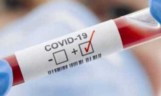 যশোরে আরো ৪১ জনের করোনা শনাক্ত