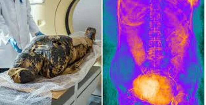 ২ হাজার বছরের মমির গর্ভে আজও অক্ষত সন্তান!