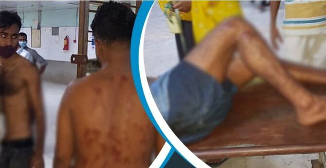 টঙ্গীতে পোশাককর্মীদের ঈদ ছুটি নিয়ে উত্তেজনা, ছররা গুলিতে আহত ৯