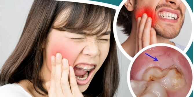 আক্কেল দাঁত ওঠে কেন? প্রচণ্ড ব্যথা হলে করণীয়