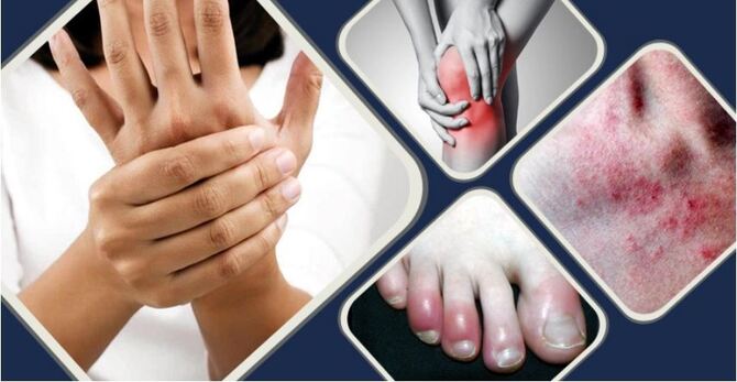 যে ১০ লক্ষণে বুঝবেন রোগ প্রতিরোধ ক্ষমতা কমে গেছে