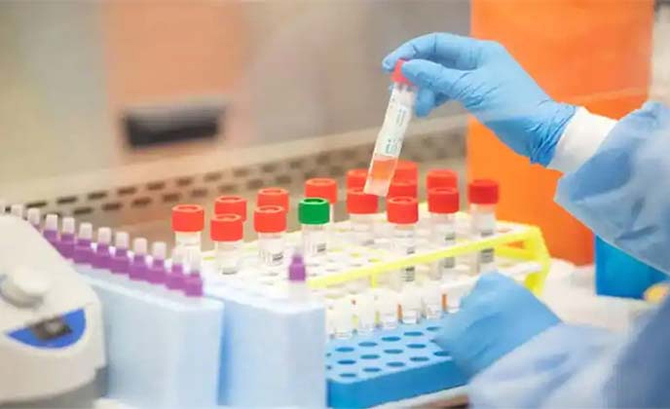 দেশে করোনায় ২৪ ঘন্টায় ১৪৩ জনের মৃত্যু, শনাক্ত ৮৩০১