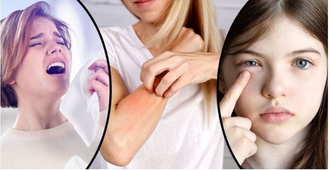 অ্যালার্জি থেকে মুক্তি মিলবে ৫ তেলে