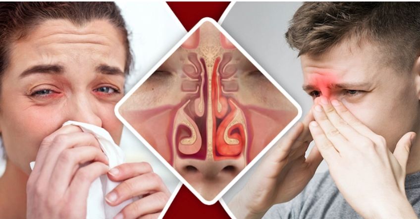 ওষুধ ছাড়াই সাইনাসের ব্যথা কমানোর ৫ উপায়