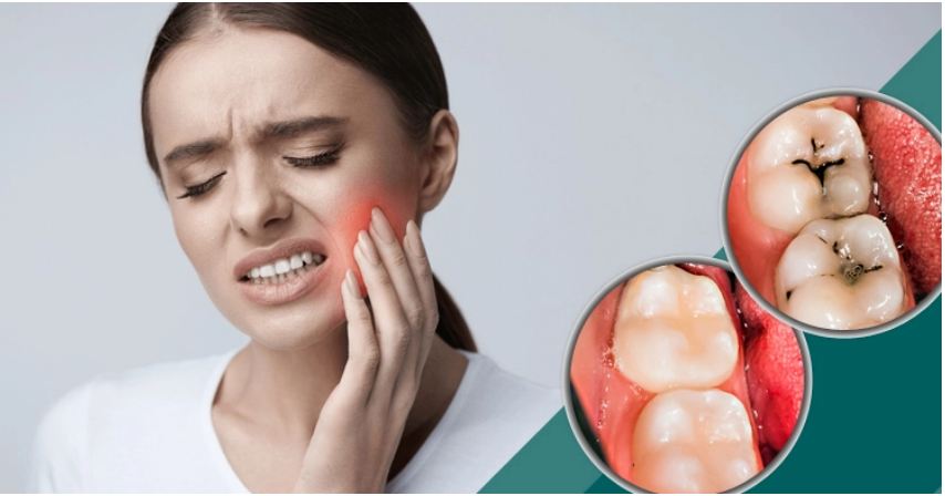 দাঁত ক্ষয় হয়ে যাচ্ছে? ঠেকাতে যা করবেন