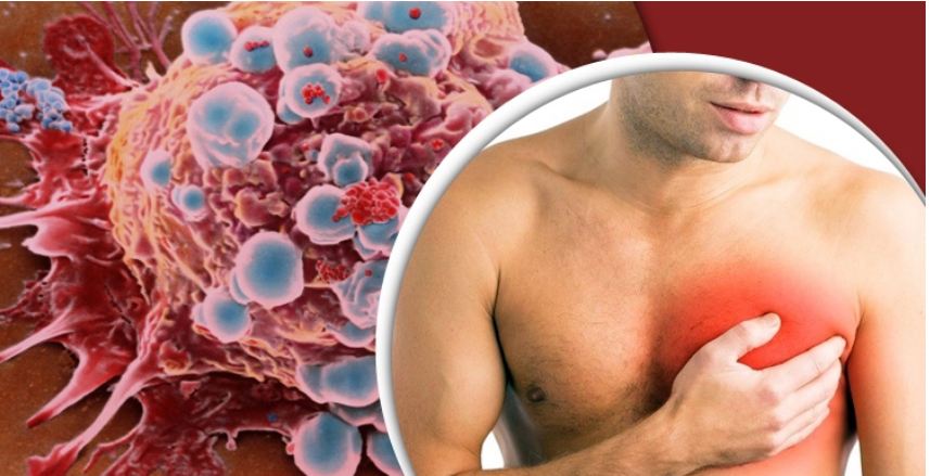 পুরুষের ব্রেস্ট ক্যান্সারের ৪ লক্ষণ, অবহেলা করলেই বিপদ!