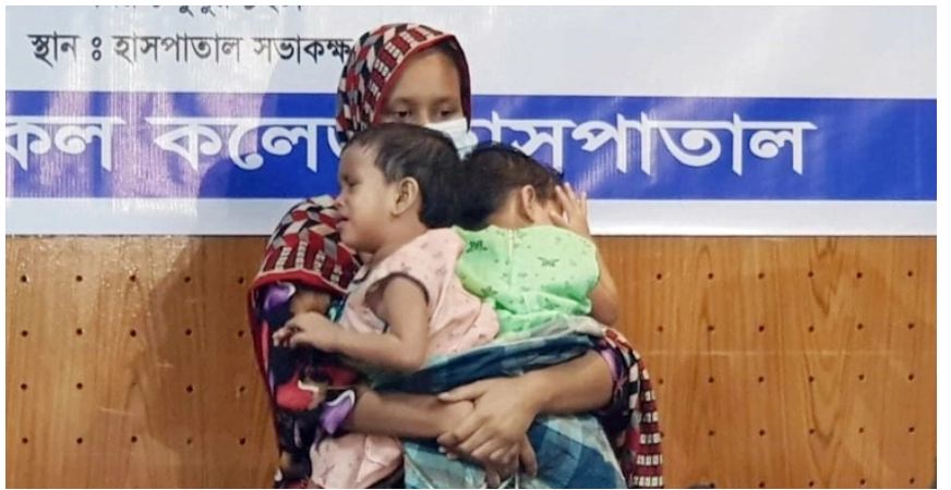 লাবিবা-লামিসার প্রথম অপারেশন শেষ, ৬ সপ্তাহ পর পৃথক করার সিদ্ধান্ত
