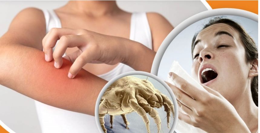 বিছানায় থাকা যে পোকার কামড়ে হতে পারে অ্যালার্জি